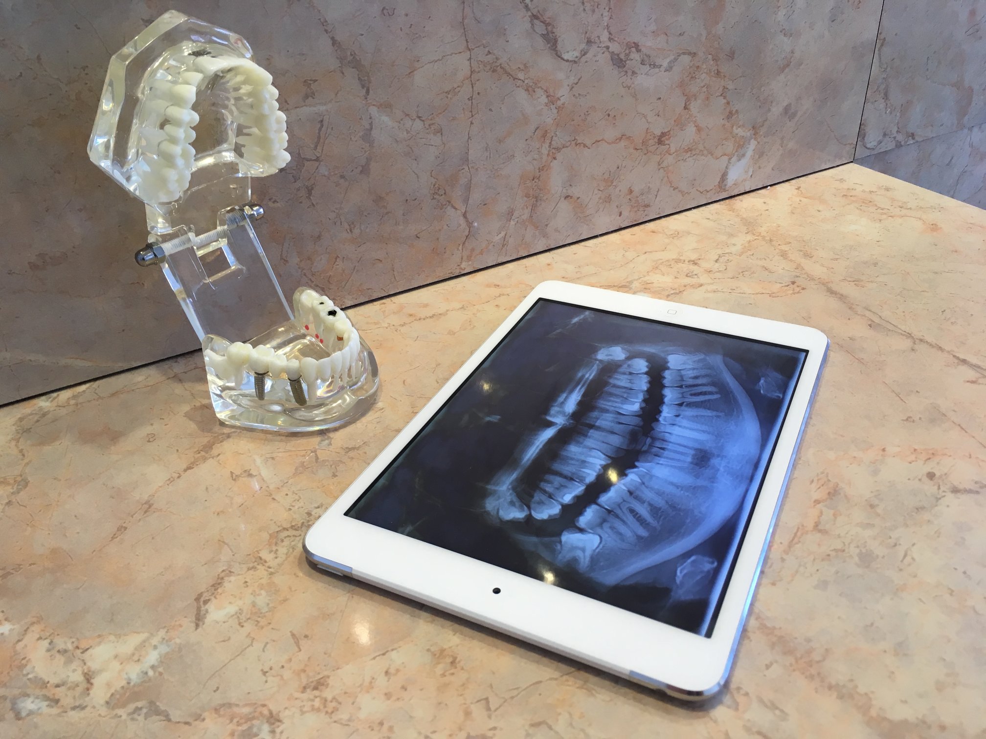 A patient in our Budapest clinic before a free consultation. The dental assistant informs the patient about the consultation process.