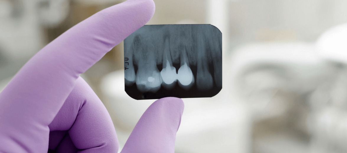 Digital X-ray at the Artdent Dentistry